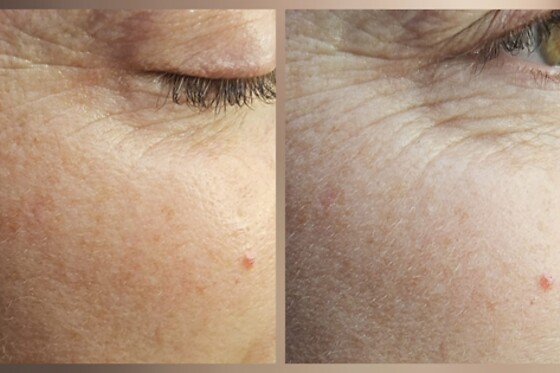 Fountain of Youth - photo 4